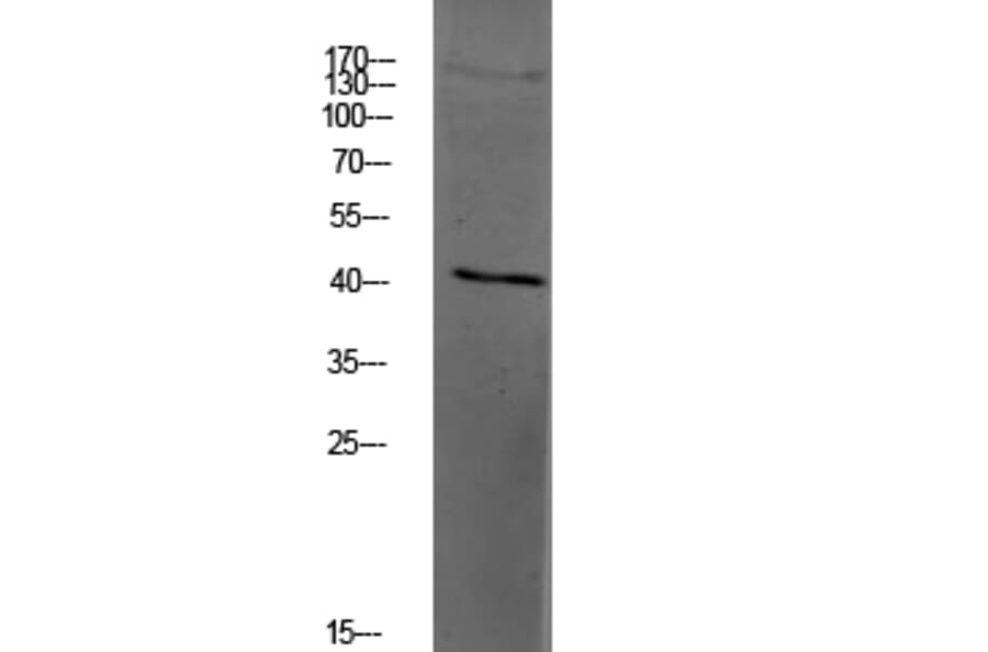Western Blot - Anti-PAR4 Antibody (G939) - Antibodies.com