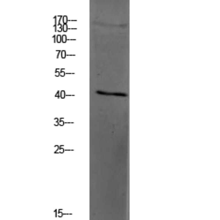 Western Blot - Anti-PAR4 Antibody (G939) - Antibodies.com