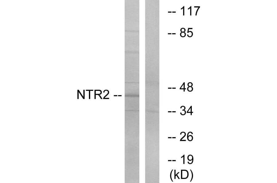 Western Blot - Anti-NTR2 Antibody (G414) - Antibodies.com