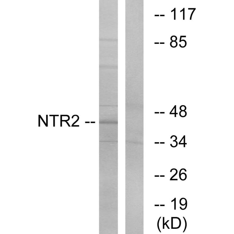 Western Blot - Anti-NTR2 Antibody (G414) - Antibodies.com