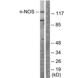 Western Blot - Anti-nNOS Antibody (B0527) - Antibodies.com