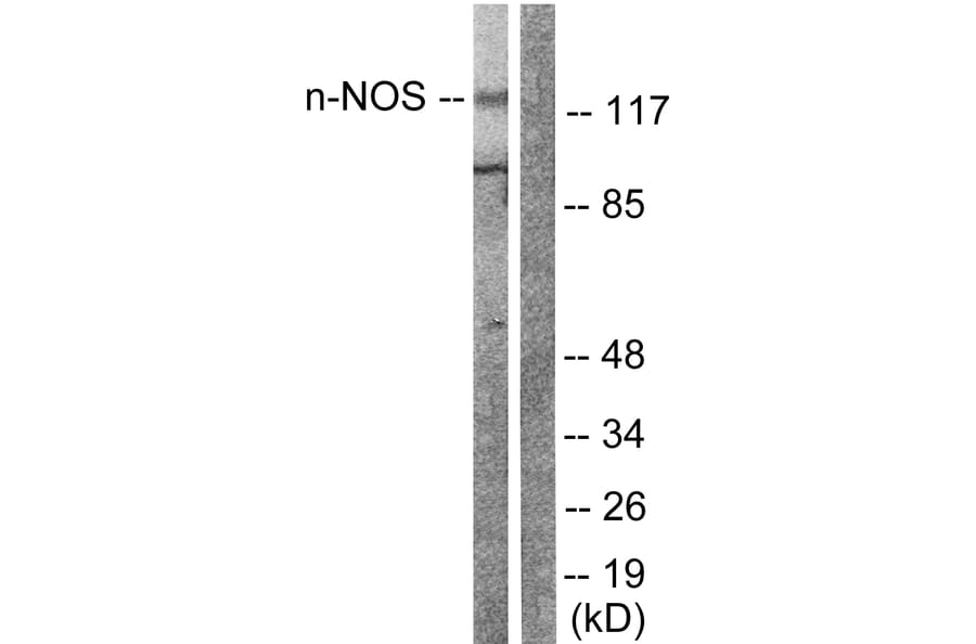 Western Blot - Anti-nNOS Antibody (B0527) - Antibodies.com