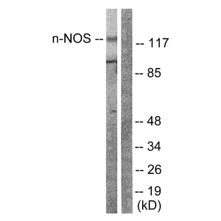 Western Blot - Anti-nNOS Antibody (B0527) - Antibodies.com