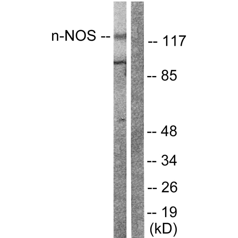 Western Blot - Anti-nNOS Antibody (B0527) - Antibodies.com