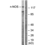 Western Blot - Anti-nNOS Antibody (B0527) - Antibodies.com