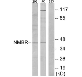 Western Blot - Anti-NMBR Antibody (G405) - Antibodies.com