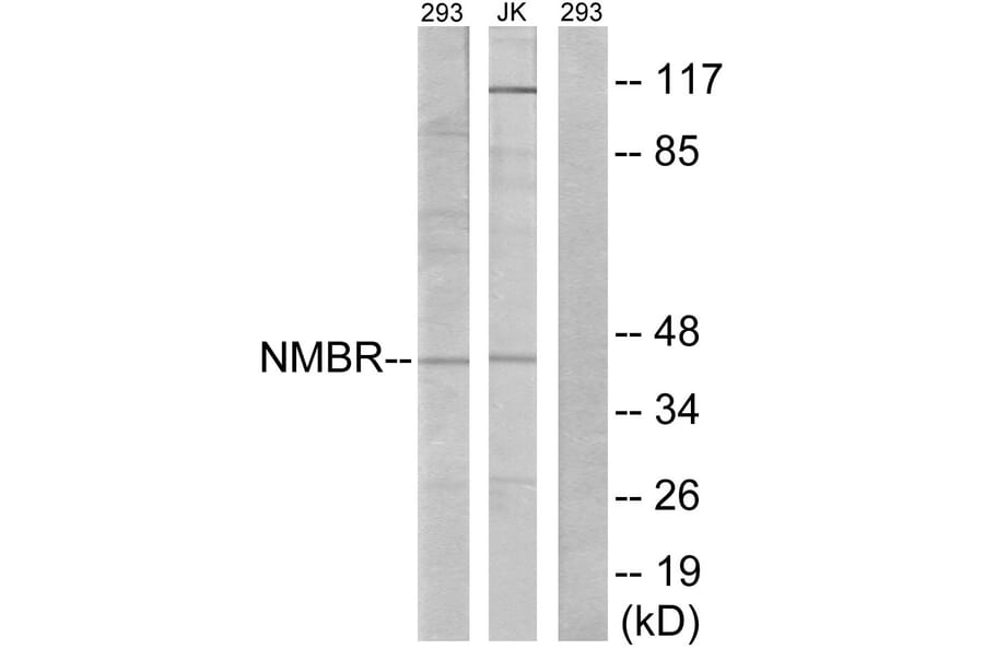 Western Blot - Anti-NMBR Antibody (G405) - Antibodies.com