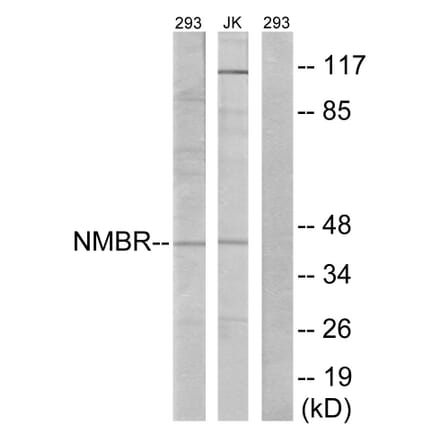 Western Blot - Anti-NMBR Antibody (G405) - Antibodies.com