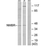 Western Blot - Anti-NMBR Antibody (G405) - Antibodies.com