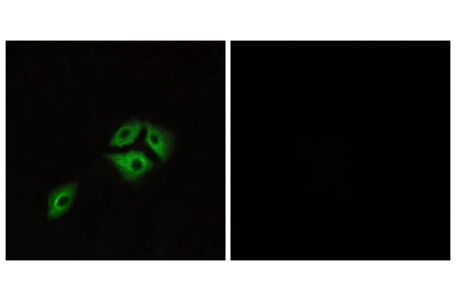 Immunofluorescence - Anti-NMBR Antibody (G405) - Antibodies.com