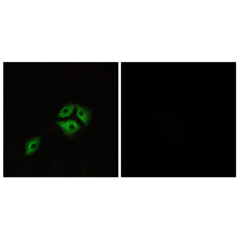 Immunofluorescence - Anti-NMBR Antibody (G405) - Antibodies.com