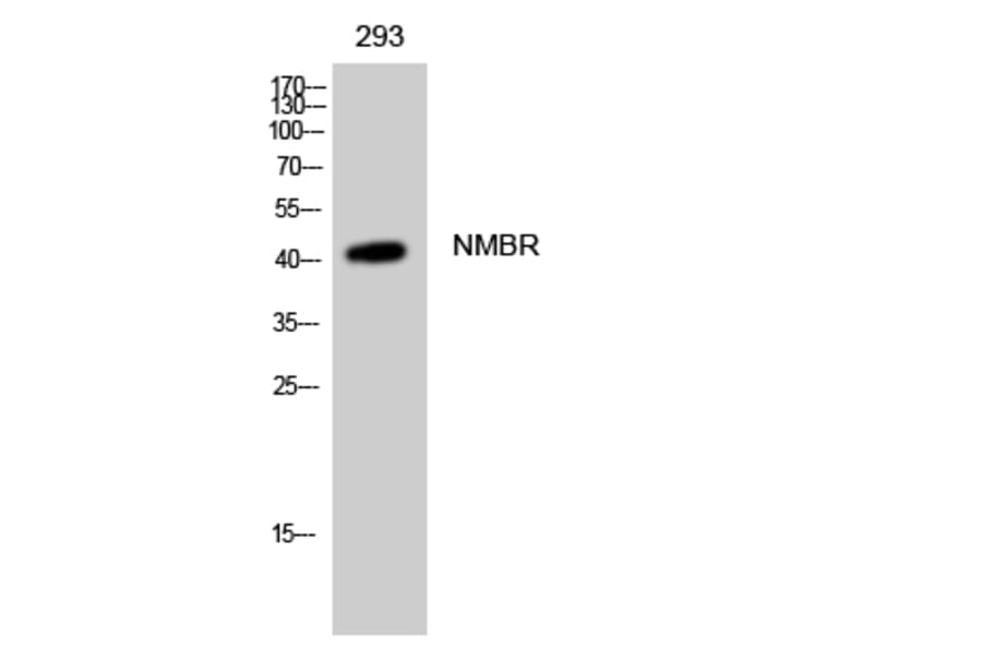 Western Blot - Anti-NMBR Antibody (G405) - Antibodies.com