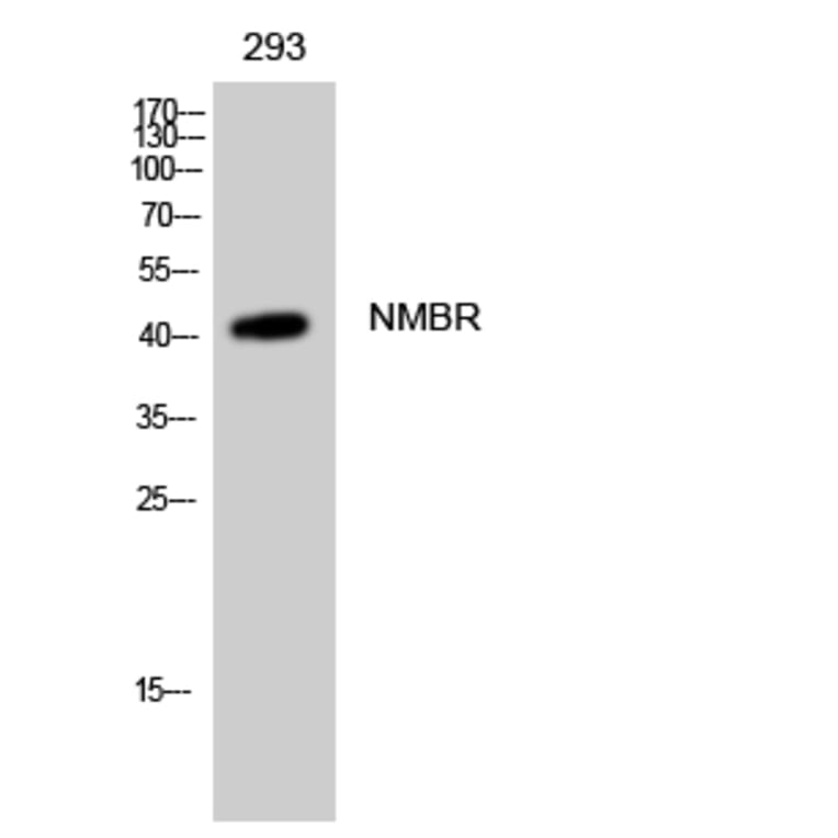 Western Blot - Anti-NMBR Antibody (G405) - Antibodies.com
