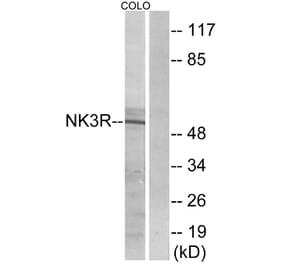 Western Blot - Anti-NK3R Antibody (G404) - Antibodies.com