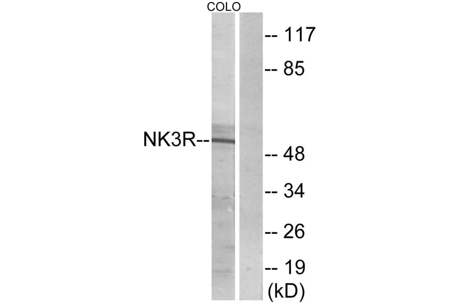 Western Blot - Anti-NK3R Antibody (G404) - Antibodies.com