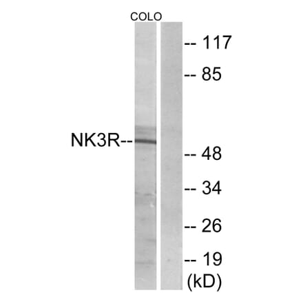 Western Blot - Anti-NK3R Antibody (G404) - Antibodies.com