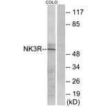 Western Blot - Anti-NK3R Antibody (G404) - Antibodies.com