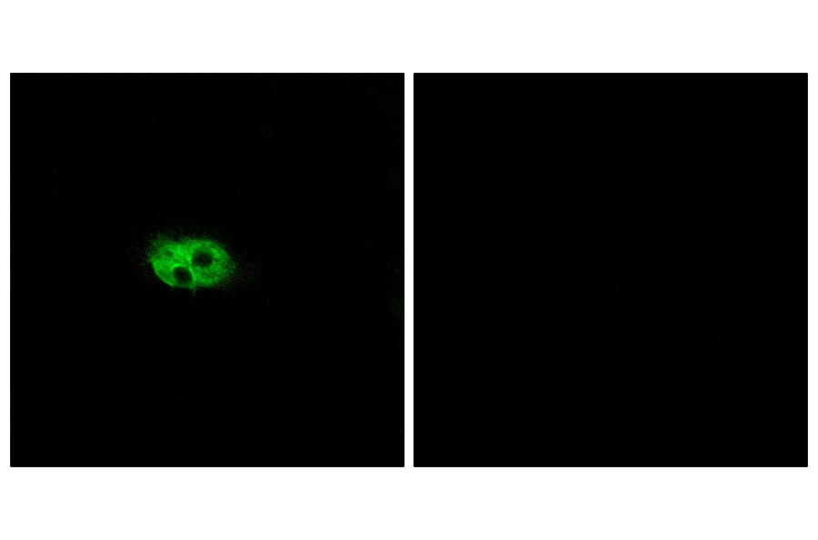 Immunofluorescence - Anti-NK3R Antibody (G404) - Antibodies.com