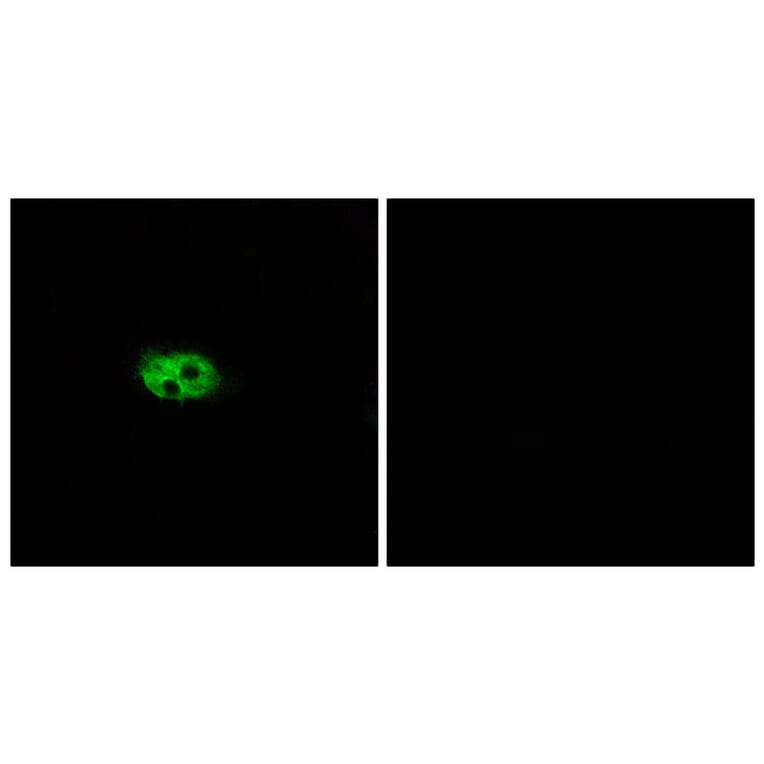 Immunofluorescence - Anti-NK3R Antibody (G404) - Antibodies.com