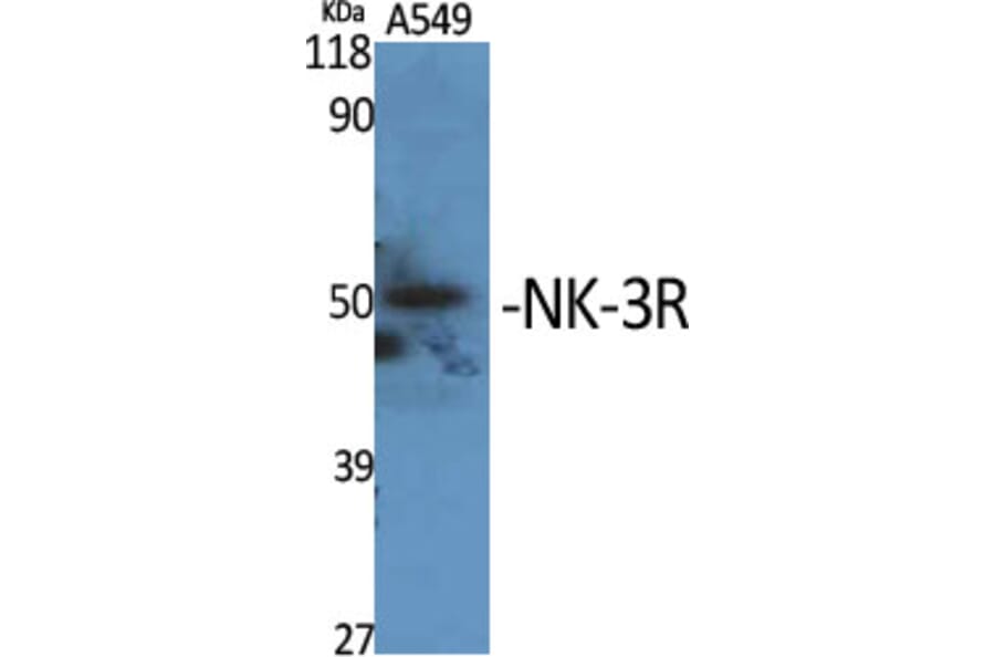 Western Blot - Anti-NK3R Antibody (G404) - Antibodies.com