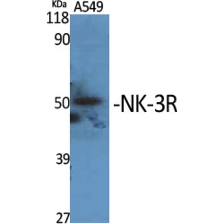 Western Blot - Anti-NK3R Antibody (G404) - Antibodies.com