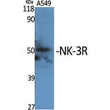 Western Blot - Anti-NK3R Antibody (G404) - Antibodies.com