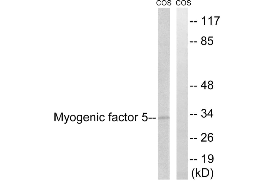 Western Blot - Anti-MYF5 Antibody (B1218) - Antibodies.com