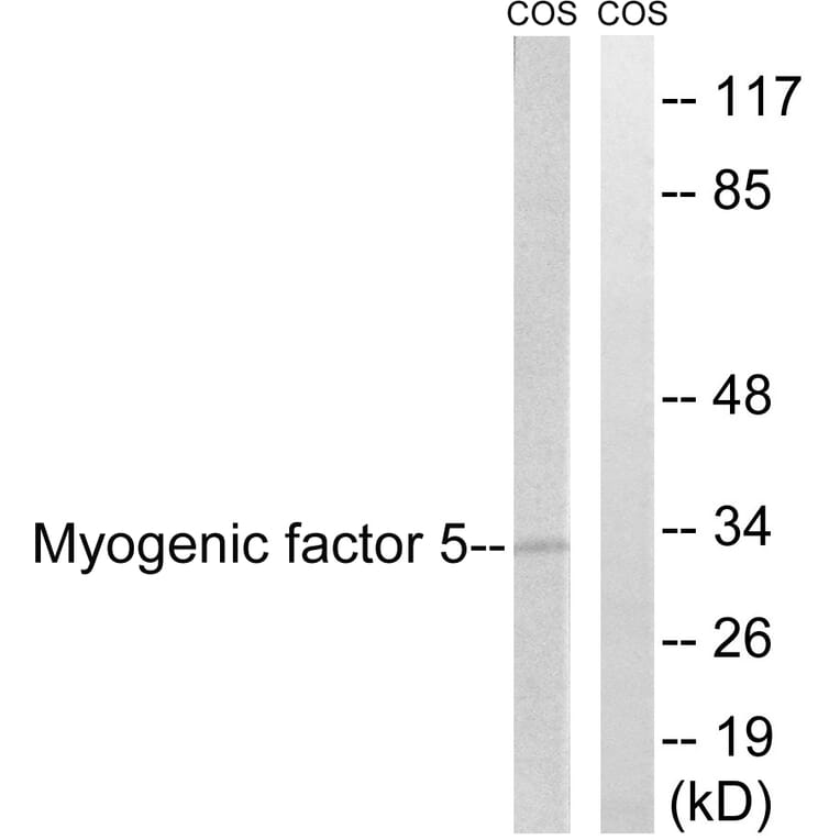 Western Blot - Anti-MYF5 Antibody (B1218) - Antibodies.com