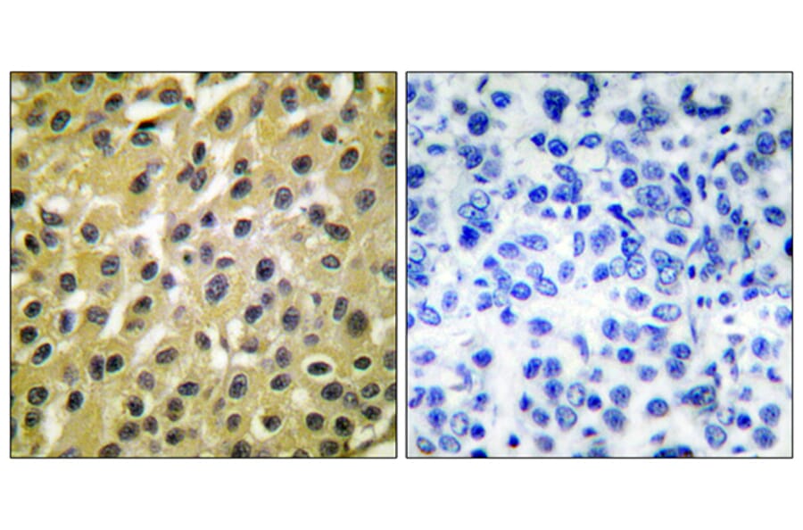 Immunohistochemistry - Anti-MDM2 Antibody (C0261) - Antibodies.com