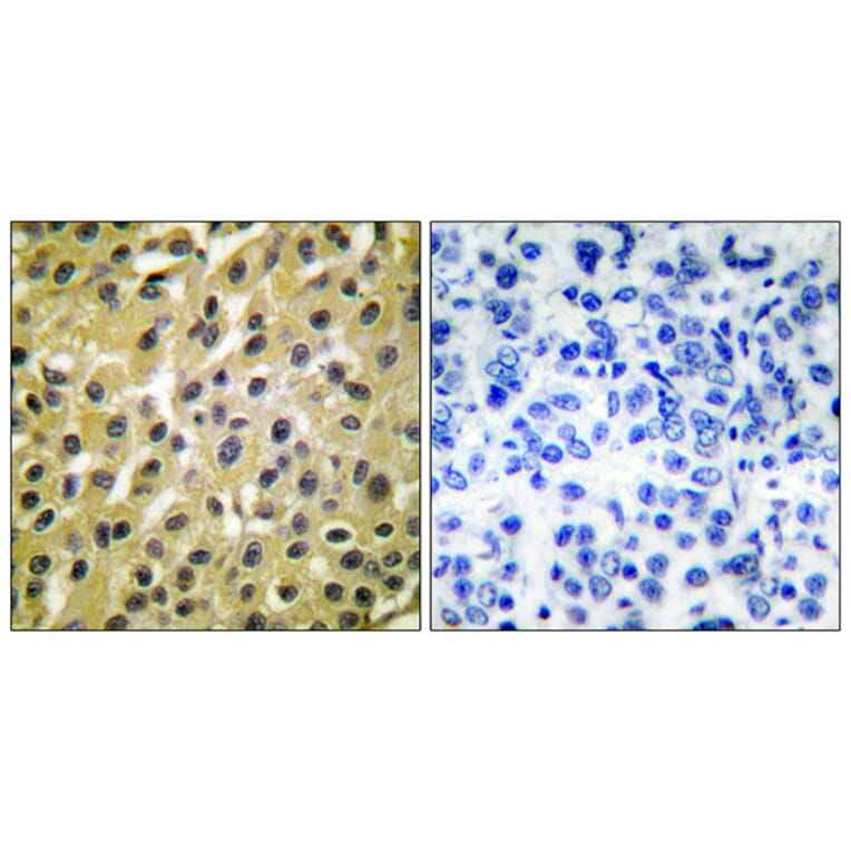Immunohistochemistry - Anti-MDM2 Antibody (C0261) - Antibodies.com
