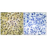 Immunohistochemistry - Anti-MDM2 Antibody (C0261) - Antibodies.com
