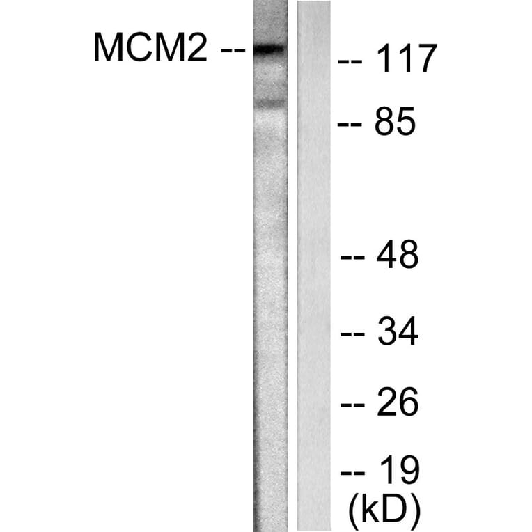 Western Blot - Anti-MCM2 Antibody (C0259) - Antibodies.com