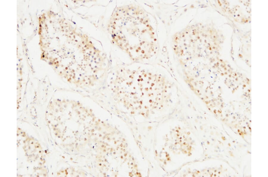 Immunohistochemistry - Anti-MCM2 Antibody (C0259) - Antibodies.com