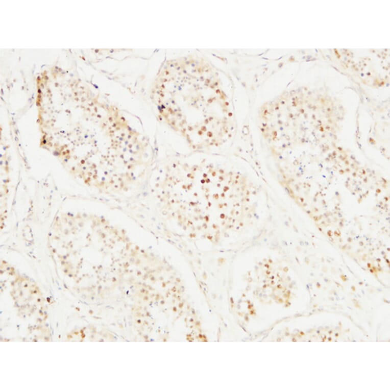 Immunohistochemistry - Anti-MCM2 Antibody (C0259) - Antibodies.com