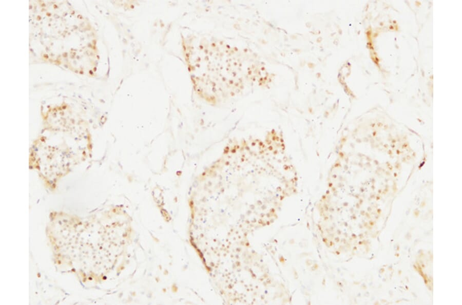 Immunohistochemistry - Anti-MCM2 Antibody (C0259) - Antibodies.com