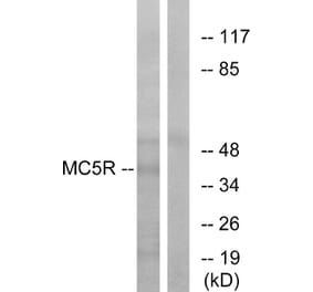Western Blot - Anti-MC5R Antibody (G385) - Antibodies.com