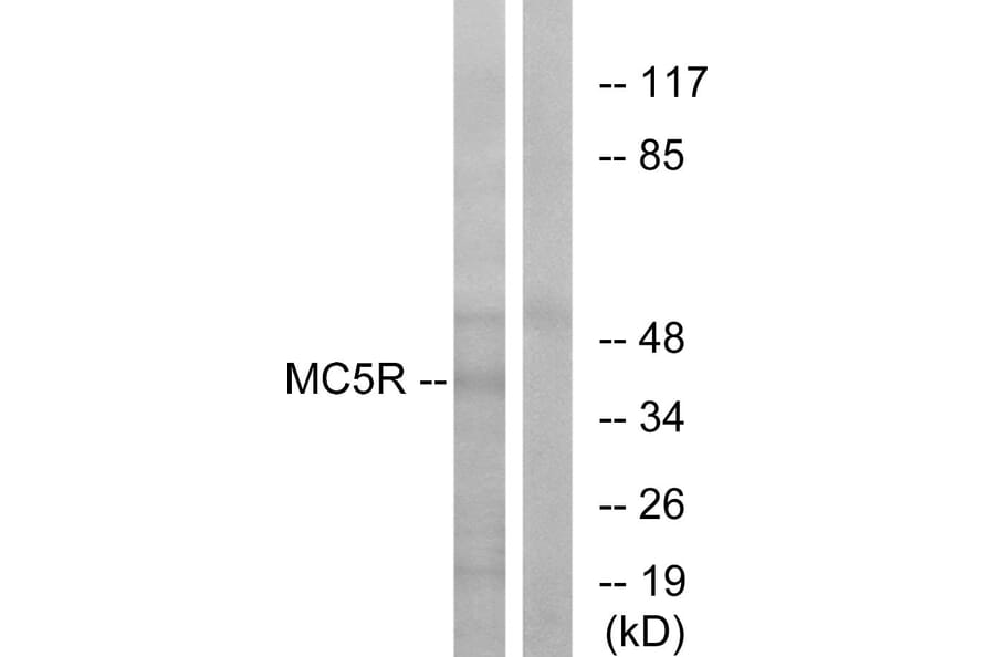 Western Blot - Anti-MC5R Antibody (G385) - Antibodies.com