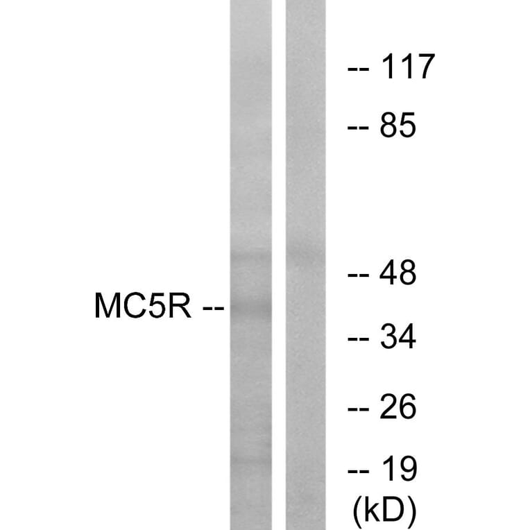 Western Blot - Anti-MC5R Antibody (G385) - Antibodies.com