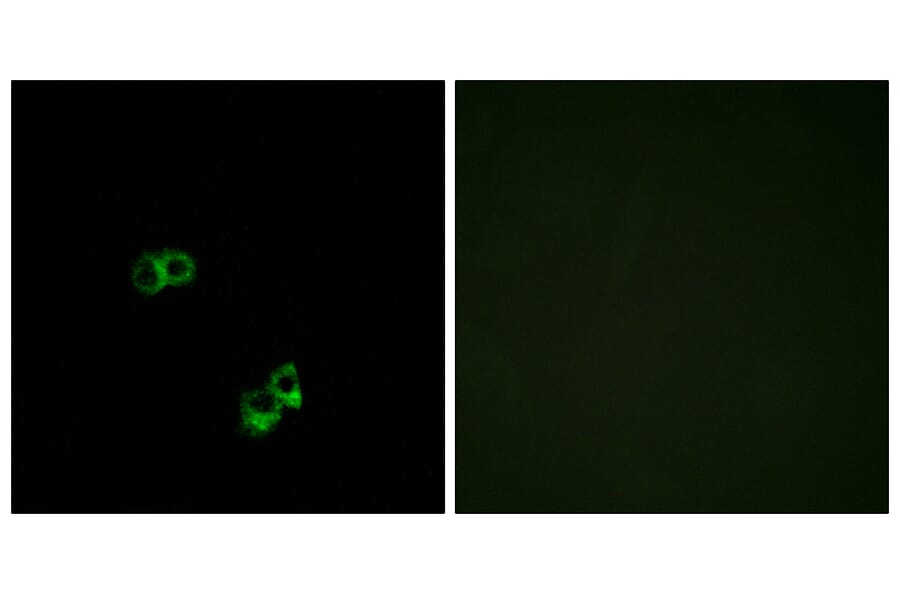 Immunofluorescence - Anti-MC5R Antibody (G385) - Antibodies.com