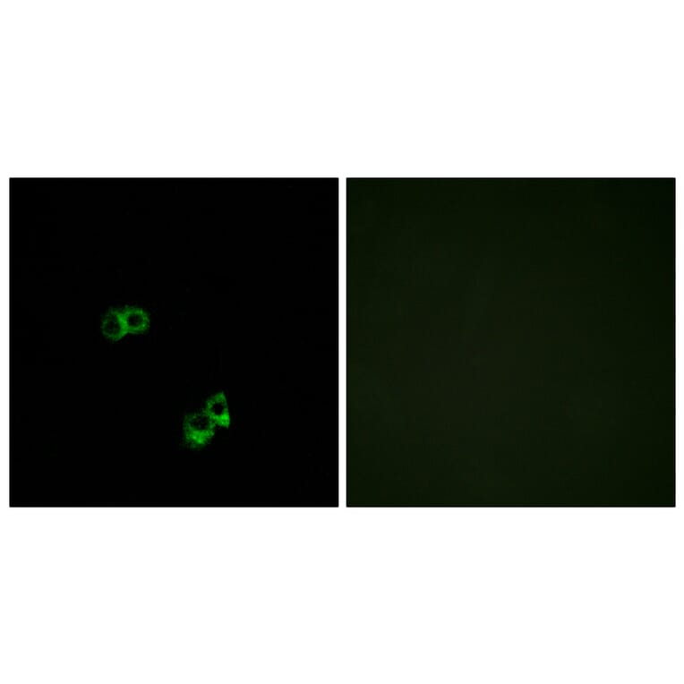 Immunofluorescence - Anti-MC5R Antibody (G385) - Antibodies.com