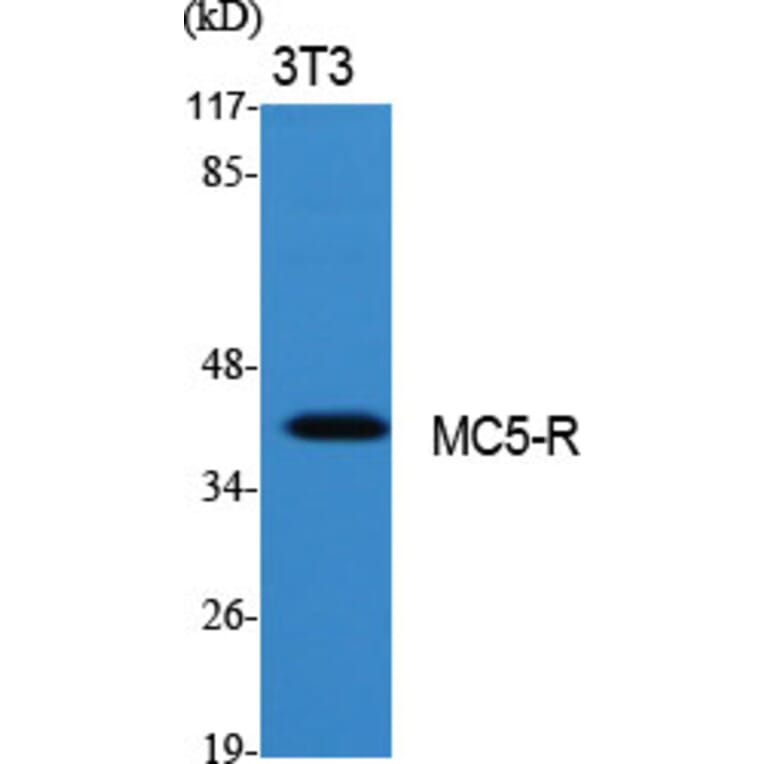 Western Blot - Anti-MC5R Antibody (G385) - Antibodies.com