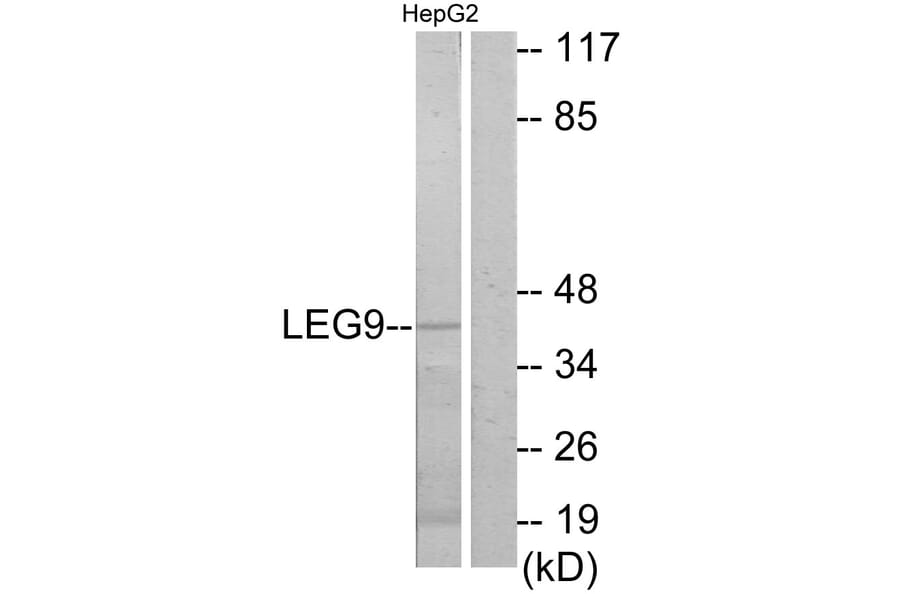 Western Blot - Anti-LEG9 Antibody (C13080) - Antibodies.com