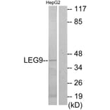 Western Blot - Anti-LEG9 Antibody (C13080) - Antibodies.com