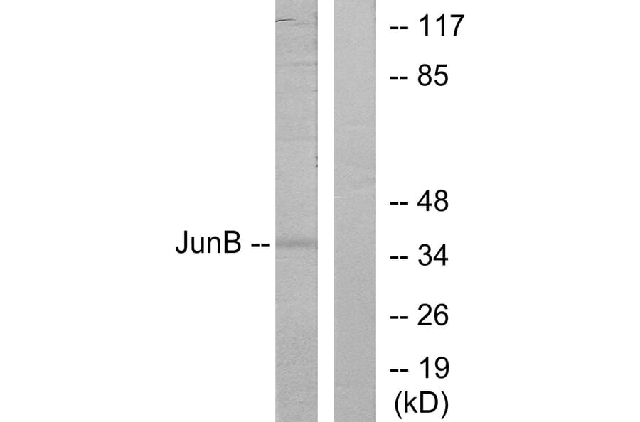 Western Blot - Anti-JunB Antibody (B7135) - Antibodies.com