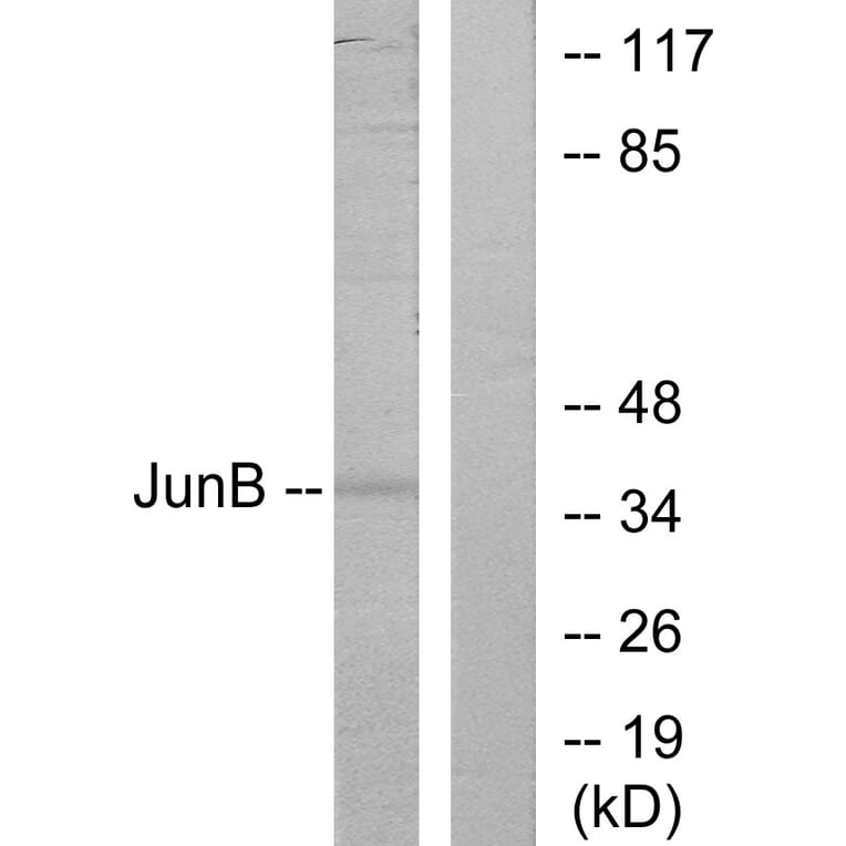 Western Blot - Anti-JunB Antibody (B7135) - Antibodies.com