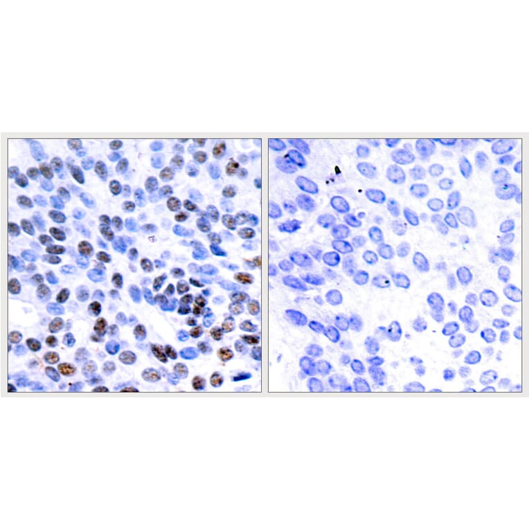 Immunohistochemistry - Anti-JunB Antibody (B7135) - Antibodies.com