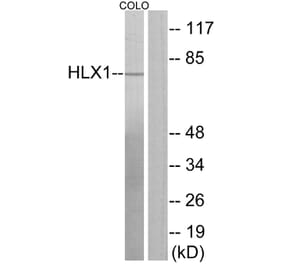 Western Blot - Anti-HLX1 Antibody (C11046) - Antibodies.com