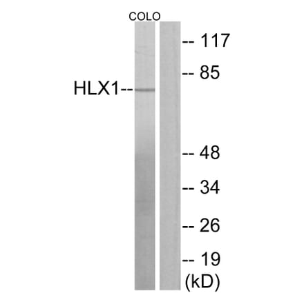 Western Blot - Anti-HLX1 Antibody (C11046) - Antibodies.com