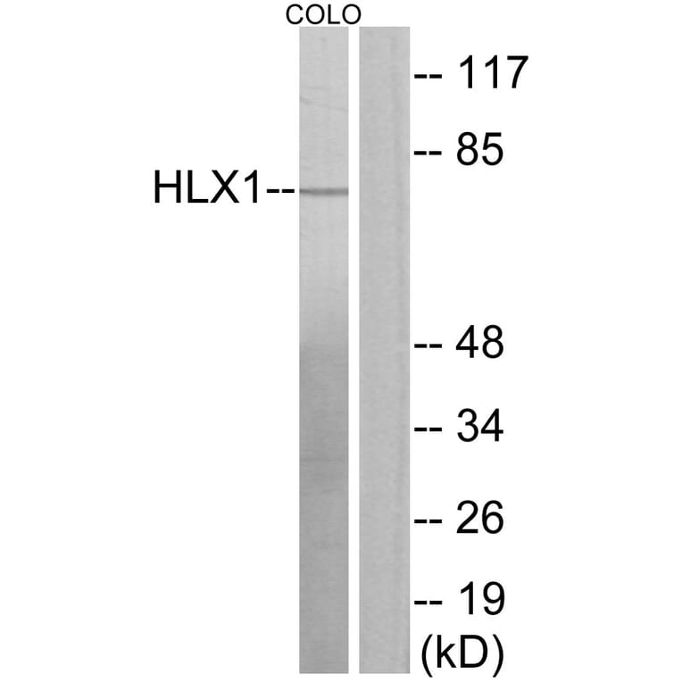 Western Blot - Anti-HLX1 Antibody (C11046) - Antibodies.com