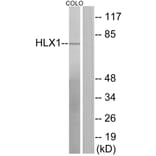Western Blot - Anti-HLX1 Antibody (C11046) - Antibodies.com
